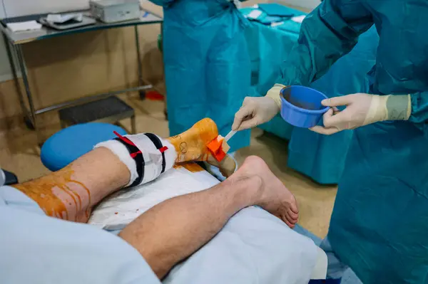 Nicht Wiederzuerkennendes Chirurgenteam Das Krankenhaus Einen Fuß Operiert Gesundheitskonzept — Stockfoto