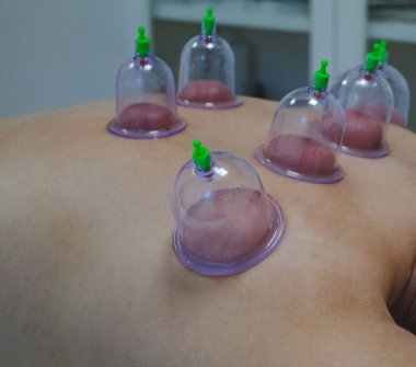 Bardak masajı, masaj odasındaki kadın vücuduna masaj. Yüksek kalite fotoğraf