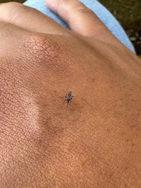 İnsan Cildindeki Küçük Böcek Ayrıntılı Görünüm