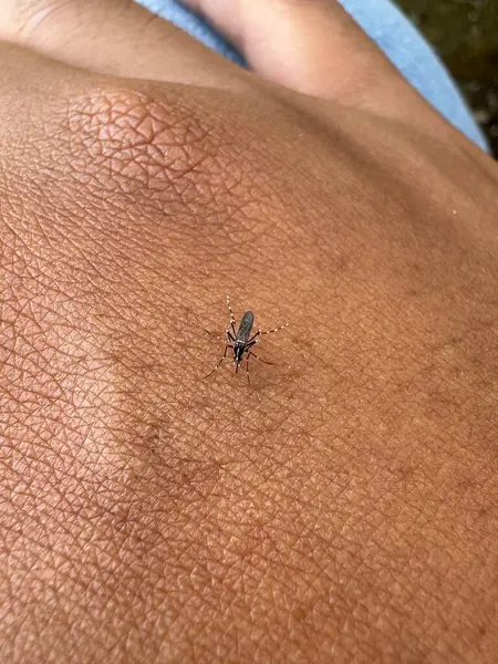 İnsan derisi üzerinde detaylı doku ve böcek gösteren bir sivrisineğin yakın görüntüsü.