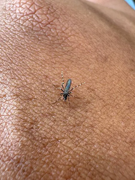 İnsan Derisi Üzerine Bir Sivrisineğin Yakın Çekimi İnsan Derisi Üzerine Böcek Derisi Üzerine Detaylı Bakış