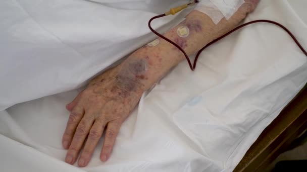 Ankara Turkey March 2021 Elderly Patient Hospital Setting Connected Blood — Stock Video