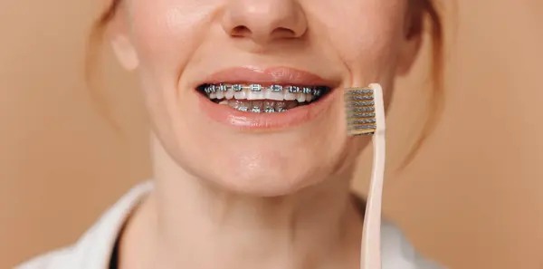 ベージュの背景に歯ブラシを保持するブレースのクローズアップ女性 ロイヤリティフリーのストック写真