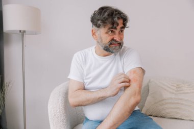 Evdeki oturma odasında oturan yaşlı adam kolunun ön kısmını kaşıyordu. Alerji belirtileri. Boşluğu kopyala