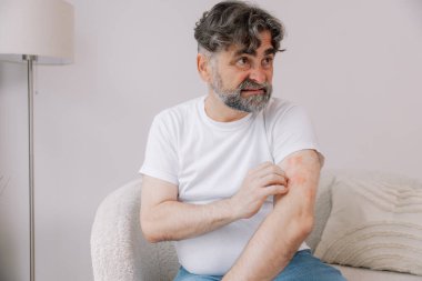 Evdeki oturma odasında oturan yaşlı adam kolunun ön kısmını kaşıyordu. Alerji belirtileri. Boşluğu kopyala