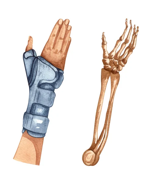 Υδατογραφία Εικονογράφηση Πρώτου Βοηθού Τραυματισμένο Χέρι Καρπό Δεμένο Χέρι Φυσικοθεραπεία — Φωτογραφία Αρχείου