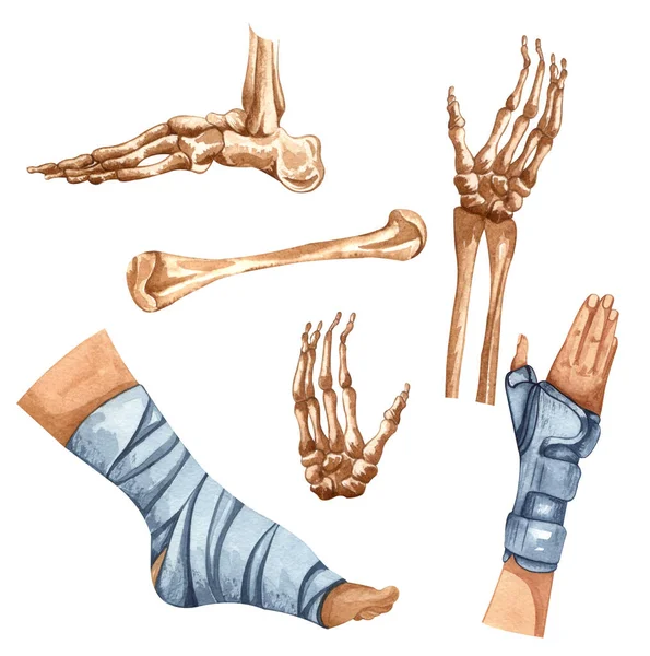 Narzędzia Ortopedyczne Ortopedyczne Zestaw Akwareli Medycznych Fizjoterapia Ilustracje Zraniona Noga — Zdjęcie stockowe