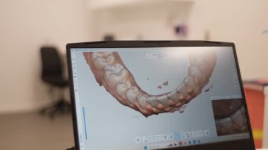 Ortodontik randevusu olan bir kadın. Diş teli tedavisinden sonra özel diş tellerini hazırlamak için 3 boyutlu tarama yaptırıyor. Güzel gülümsemesini korumak için bir adım.