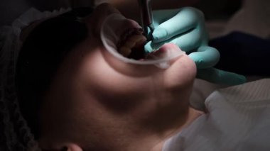 Ortodonti muayenehanesinde ameliyat olan bir kız. Yakın plan: ortodontist dikkatlice diş tellerini çıkarırken ağzı açık. Düzgün, sağlıklı bir gülümseme konsepti 