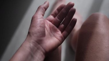 Yakından bakınca, bir kadın avuç içini egzamayla gösteriyor. Ellerinde kırmızı, kuru ve ıslak bir deri var. En iyi bilimsel, klinik veya belgesel kullanımı için kullanılır. 