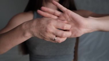 Kızarık, kırmızı, kaşındıran deri bantları olan bir kız eli. Dermatolojik semptomları ve tedavi ihtiyacını göstermek için ideal..