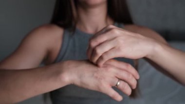 Kız, egzamadan etkilenmiş avuçlarının içini yoğun bir şekilde tırmalıyor. Alerjinin sonucu olarak, kabarcıklar patlar ve deri kurur, taneler oluşur. Tıbbi görüntüleme için ideal