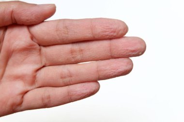 Suda çok uzun süre kalmaktan ellerim buruşmuş..