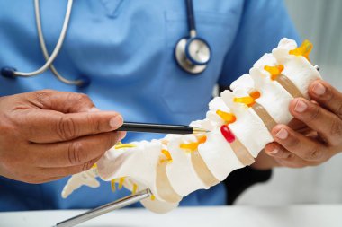 Ortopedi bölümünde tedavi için omurga iskeleti ve sinir modeline sahip bir doktor..