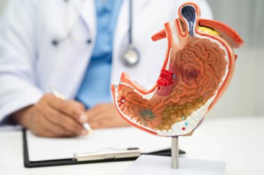 Mide hastalığı, hastanede teşhis ve tedavi için anatomi modeli tutan bir doktor..