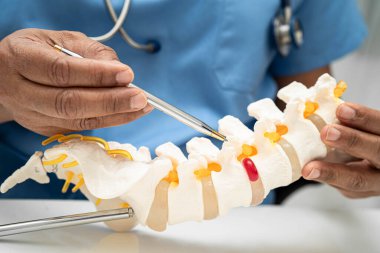 Omurga ve kemik modeli taşıyan Asyalı doktor, ortopedi bölümünde tedavi için bel kemiği yerinden oynamış disk parçası..