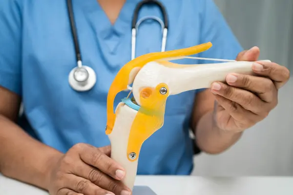 Diz eklem iltihabı, doktor diz eklemi ve ortopedik eklem gösteriyor.. 