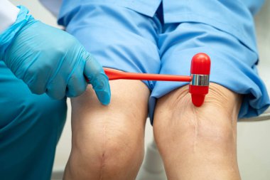 Asyalı doktor, hastanedeki yaşlı hastayı muayene etmek için diz refleksi sinirine vurdu..