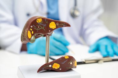 Dünya Hepatit Günü 'nde siroz, karaciğer kanseri, yağlı karaciğer, karaciğer anatomisi olan Asyalı doktor..