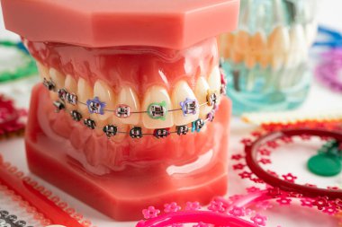 Ortodontik bağlar halkalar ve kravatlar, diş hekimliği üzerine çalışan dişçi için model..