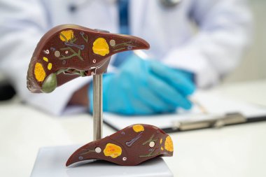 Dünya Hepatit Günü 'nde siroz, karaciğer kanseri, yağlı karaciğer, karaciğer anatomisi olan Asyalı doktor..