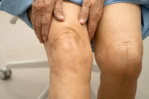 Hastanede dizinde yara izi olan Asyalı yaşlı bir hasta var..