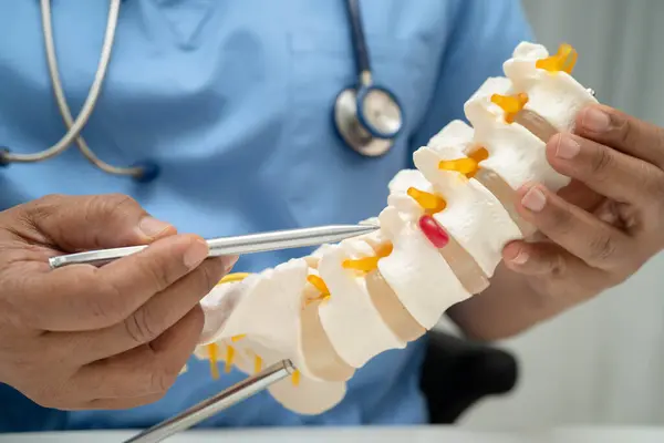 Omurga ve kemik modeli taşıyan Asyalı doktor, ortopedi bölümünde tedavi için bel kemiği yerinden oynamış disk parçası..