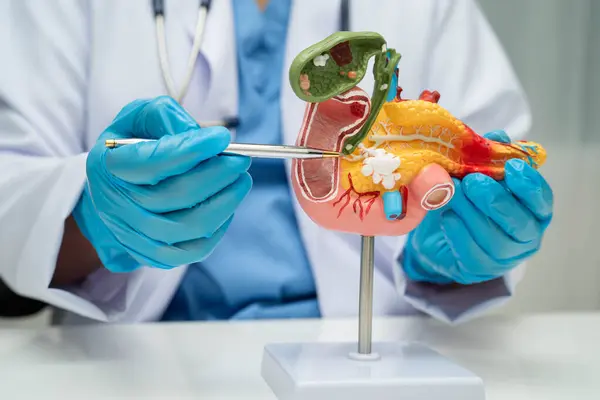 Pankreas iltihabı, pankreas hastası Asyalı doktor, safra kesesi ve safra kesesi insan anatomisi modeli..