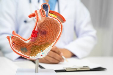 Mide hastalığı, hastanede teşhis ve tedavi için anatomi modeli tutan bir doktor..