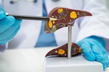 Dünya Hepatit Günü 'nde siroz, karaciğer kanseri, yağlı karaciğer, karaciğer anatomisi olan Asyalı doktor..