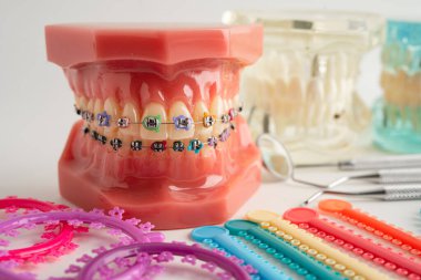 Ortodontik bağlar halkalar ve kravatlar, diş hekimliği üzerine çalışan dişçi için model..