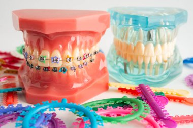 Ortodontik bağlar halkalar ve kravatlar, diş hekimliği üzerine çalışan dişçi için model..