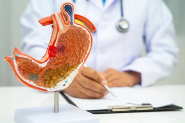 Mide hastalığı, hastanede teşhis ve tedavi için anatomi modeli tutan bir doktor..