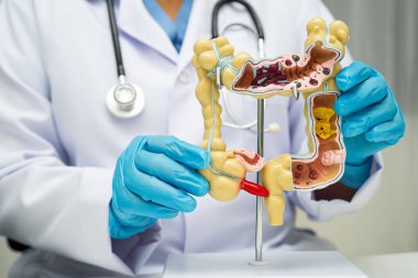 Bağırsak, hastanede teşhis ve tedavi için insan anatomisi modeli tutan doktor..
