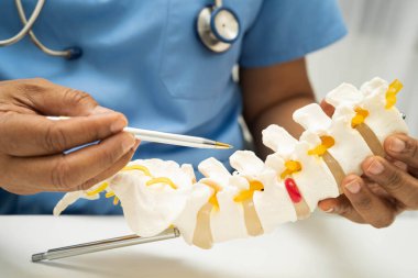 Omurga ve kemik modeli taşıyan Asyalı doktor, ortopedi bölümünde tedavi için bel kemiği yerinden oynamış disk parçası..