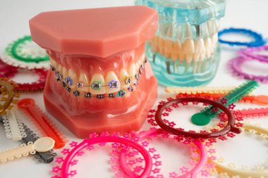 Ortodontik bağlar halkalar ve kravatlar, diş hekimliği üzerine çalışan dişçi için model..