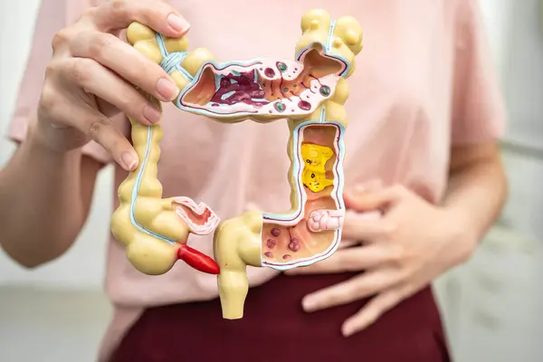 Bağırsak, Asyalı kadın insan anatomisi modeli tutuyor..