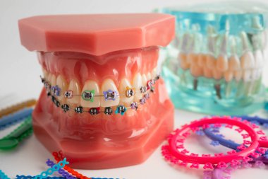 Ortodontik bağlar halkalar ve kravatlar, diş hekimliği üzerine çalışan dişçi için model..