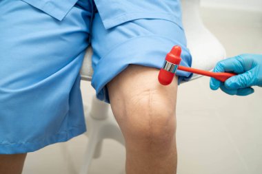 Asyalı doktor, hastanedeki yaşlı hastayı muayene etmek için diz refleksi sinirine vurdu..