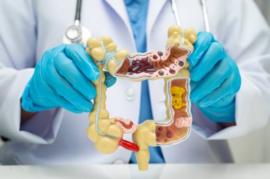 Bağırsak, hastanede teşhis ve tedavi için insan anatomisi modeli tutan doktor..
