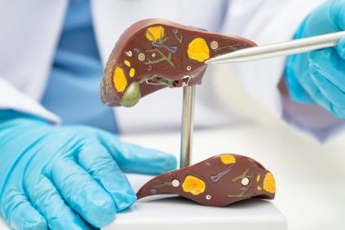 Dünya Hepatit Günü 'nde siroz, karaciğer kanseri, yağlı karaciğer, karaciğer anatomisi olan Asyalı doktor..