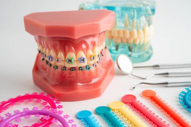 Beyaz arka planda izole edilmiş sigara, dişlerinizin sağlığına zarar verir, sigara içmezsiniz..