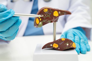 Dünya Hepatit Günü 'nde siroz, karaciğer kanseri, yağlı karaciğer, karaciğer anatomisi olan Asyalı doktor..