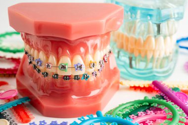 Ortodontik bağlar halkalar ve kravatlar, diş hekimliği üzerine çalışan dişçi için model..