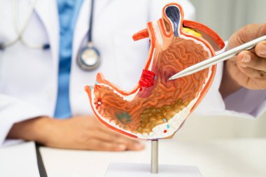 Mide hastalığı, hastanede teşhis ve tedavi için anatomi modeli tutan bir doktor..