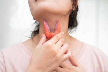 Hipertiroidizm, aşırı aktif tiroid, tiroid lenfoma, tiroid bezi insan anatomisi olan Asyalı kadın..