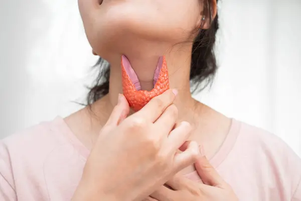 Hipertiroidizm, aşırı aktif tiroid, tiroid lenfoma, tiroid bezi insan anatomisi olan Asyalı kadın..