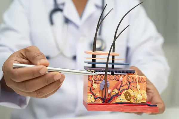 Saç nakli, Asyalı dermatolog hastanede tedavi için deri yapısı anatomisi modeli tutuyor..