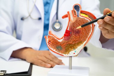 Mide hastalığı, hastanede teşhis ve tedavi için anatomi modeli tutan bir doktor..