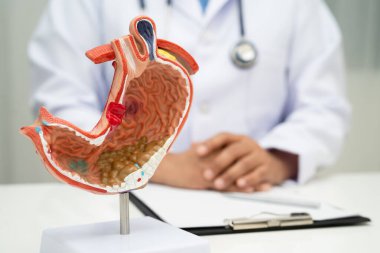 Mide hastalığı, hastanede teşhis ve tedavi için anatomi modeli tutan bir doktor..